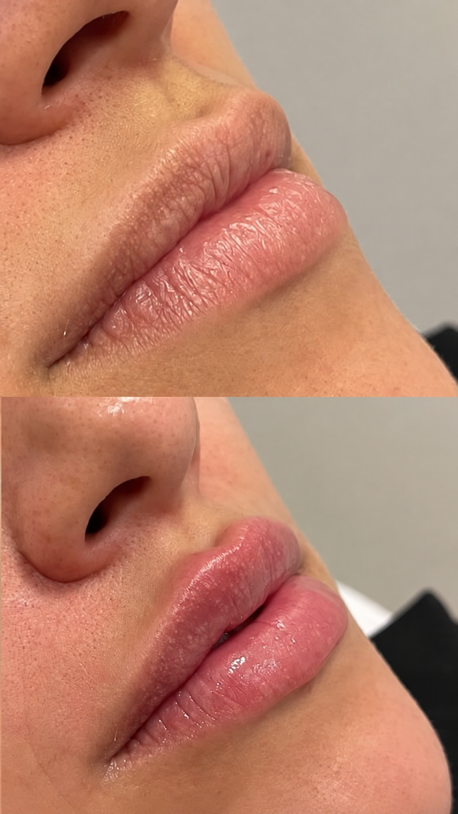 Detalhe dos lábios após cuidado facial