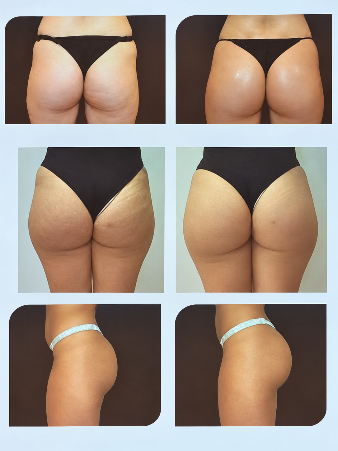 Registros fotográficos de avaliação corporal